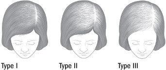 女性の薄毛や脱毛症の治療法